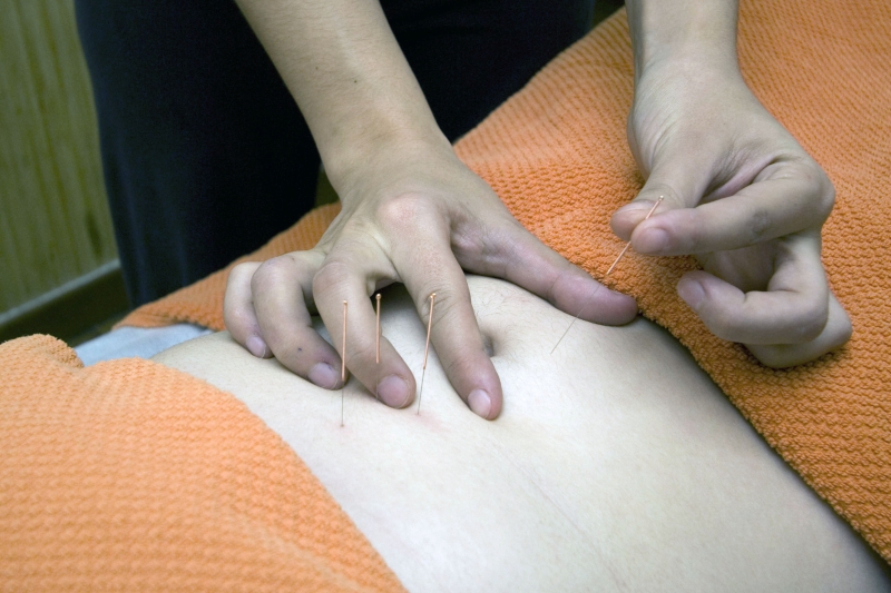 osteopathe-STE ANASTASIE SUR ISSOLE-min_acupuncture-4175625